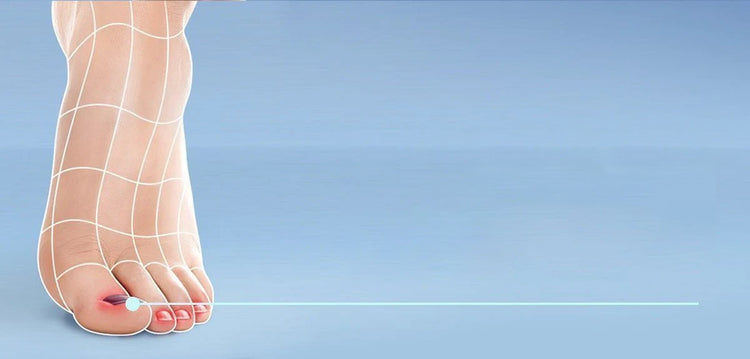 Black toenail-Scholl UK