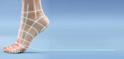 Bunions-Scholl UK