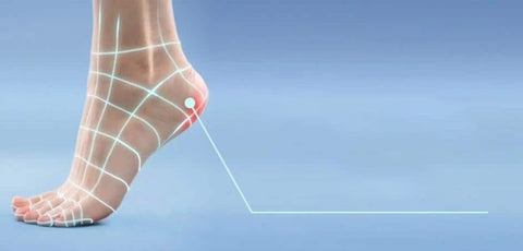 Understand and Manage: Cracked Heels-Scholl UK