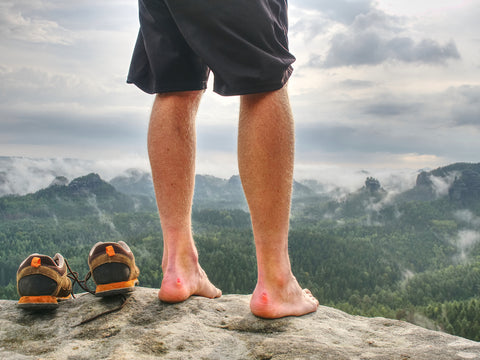 Top tips to treat blisters when hiking