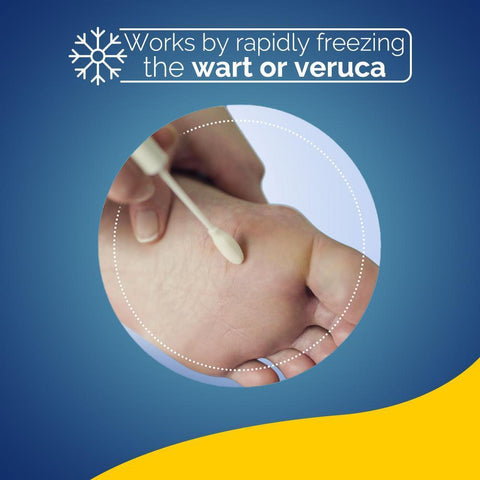 Scholl Aid Freeze Treatment Verruca & Wart Remover