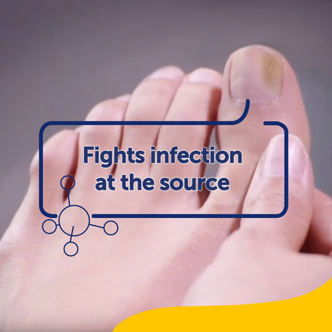 Scholl Aid Fungal Nail Treatment