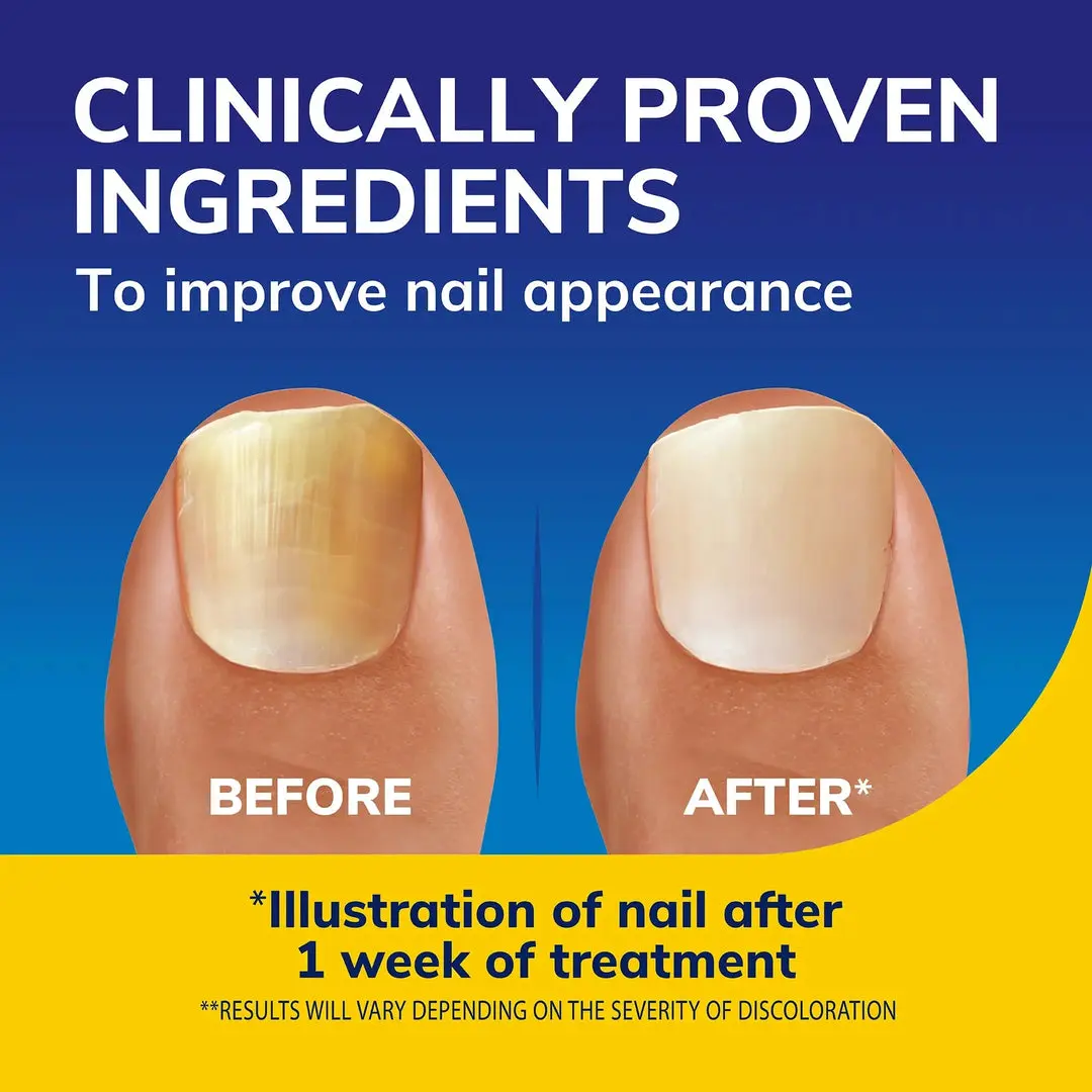 nail - Dr. Scholl's™ UK